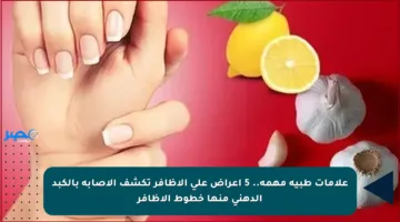 علامات طبية مهمة.. 5 أعراض على الأظافر تكشف الإصابة بالكبد الدهني منها خطوط الأظافر